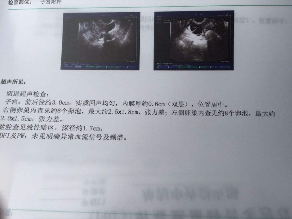 b超子宫内膜厚度是多少