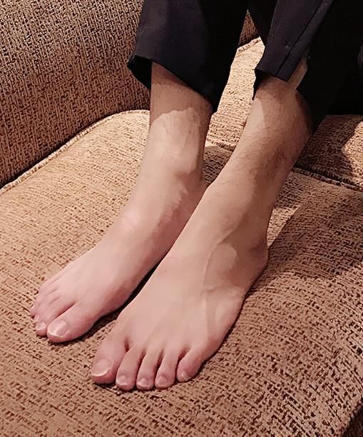 吴亦凡不剪脚趾快逼死足控了,光顾着脸帅脚都快晒脱皮了也不管
