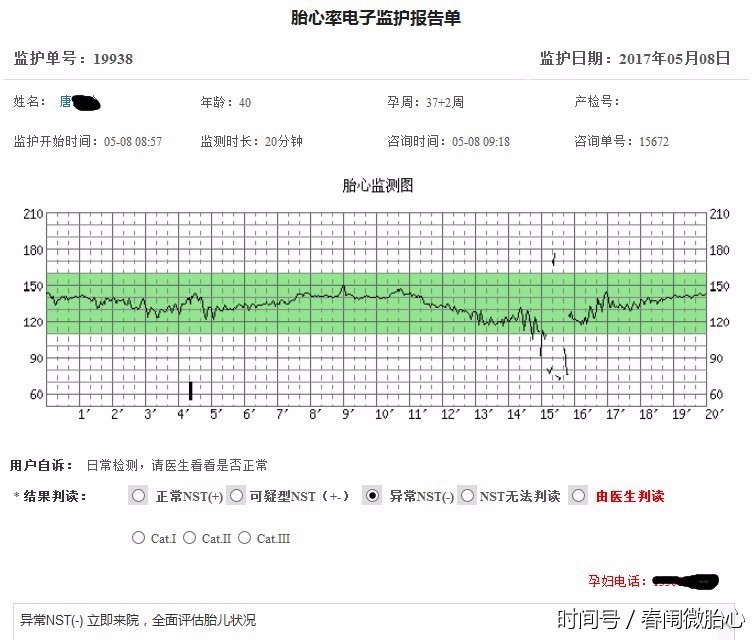 唐女士当天下午在住院部又做了两次胎心监护,结果都显示胎儿情况不太