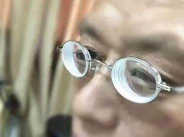 盐城高度近视的人有光明了,3000度近视眼从视力残疾变成正常人!