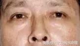 面相真人图解鼻与颧骨(鼻是主一生的财富与健康,可收藏!