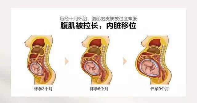 坐月子期间必须特别注意 防止内脏下垂,因内脏下垂可能为所有妇女病及