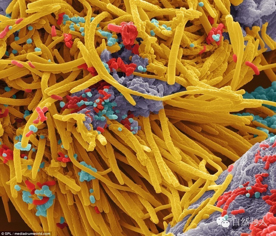 图中的细菌被放大了1万倍,还做了色彩处理.
