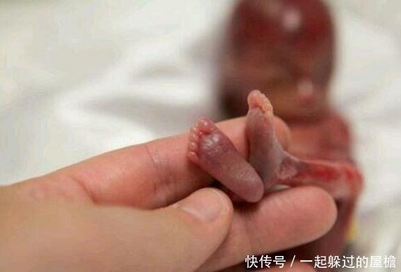 只有4个月的胎儿被迫生下,真让人心疼不已.