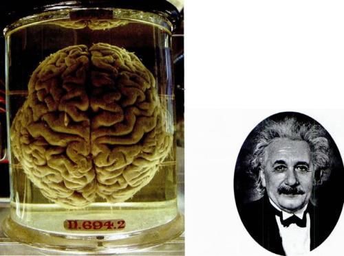 科学家爱因斯坦大脑被分成240块 最聪明的大脑到底有何过人之处