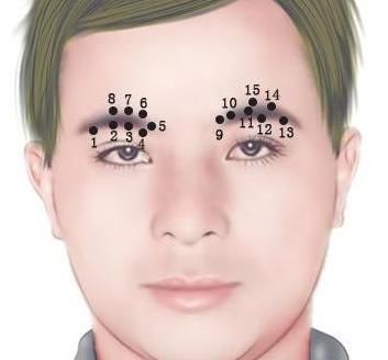 眉毛有痣意义不同,你知道左眉和右眉有痣分别代表什么