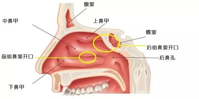 慢性鼻窦炎不伴鼻息肉 慢性鼻窦炎的典型症状: 慢性鼻窦炎为什么会