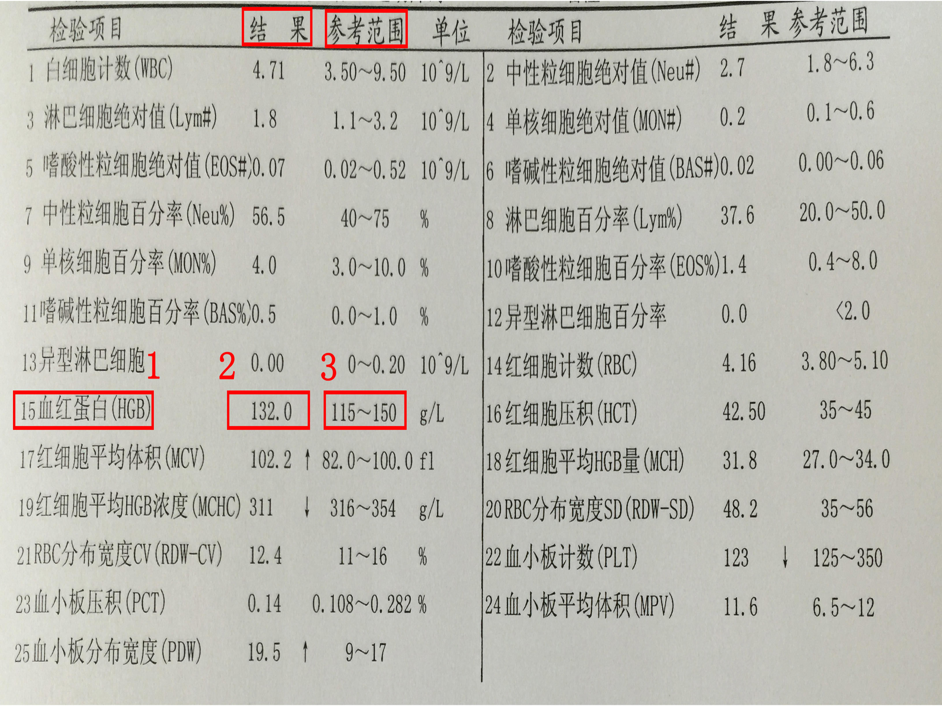 怀疑自己贫血,做什么检查