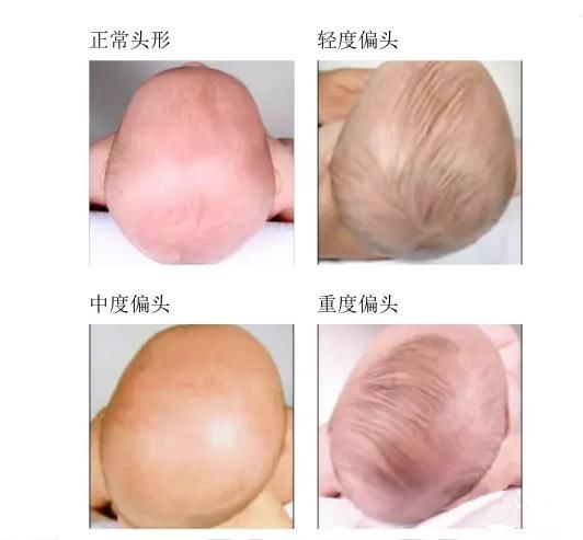远离扁头,让发型睡出好头型?短发发型圆脸图片中分宝宝图片