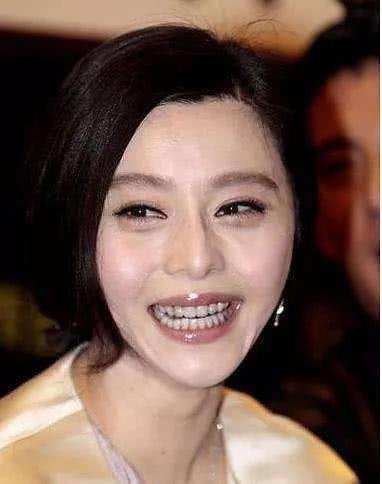 女明星们做梦都想删掉的笑崩照: 杨幂露牙床, 范冰冰似吃人, 蔡依林看