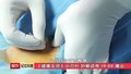 《健康北京》小刃针 妙解顽疾
