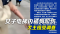 官方通报女子小区电梯内被狗咬伤：狗被收容处置，犬主接受调查