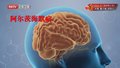 《养生堂》20250507截断大脑加速衰退期