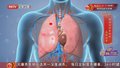 《养生堂》20250812救肺 一步走错都吃亏