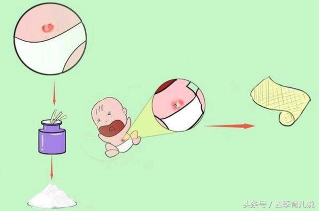 新生儿宝宝脐带多久脱落?原来讲究这么多,父母