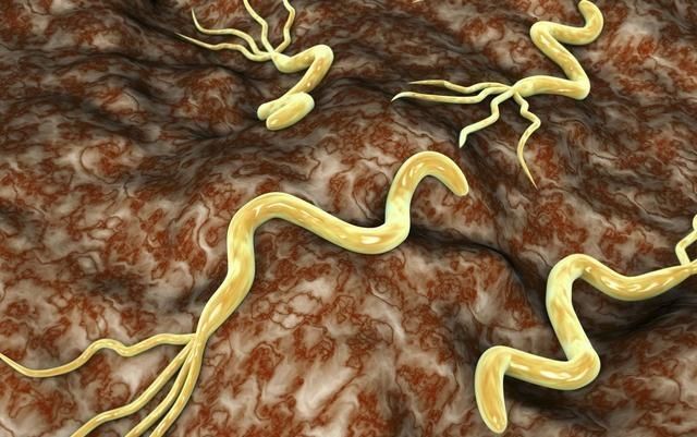 经常胃痛!你还在傻傻养幽门螺旋杆菌,用一杯水