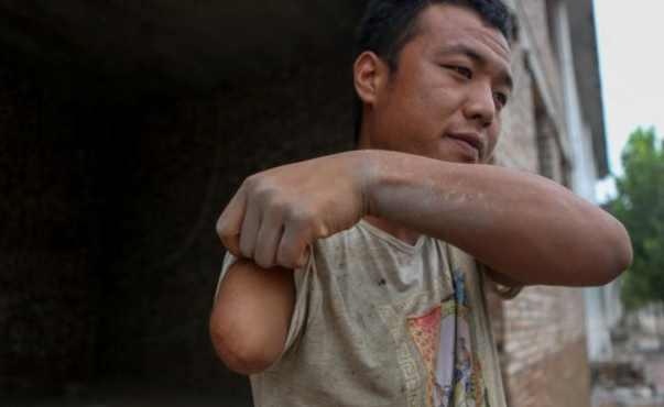 断臂男孩,工地搬砖,整水泥,月入8千,想要找个女