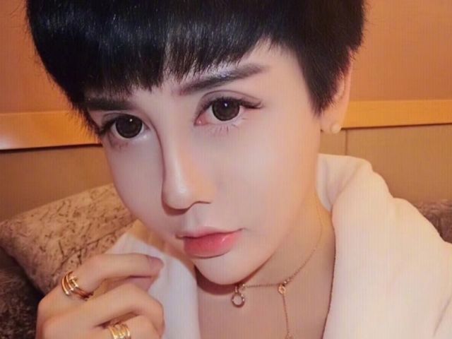 "蛇精男"刘梓晨融掉脸上玻尿酸,回归真实状态,网友直呼认不出