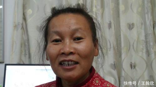 56岁大妈爱刷牙,每天睡前用牙膏敷脸,斑点皱纹