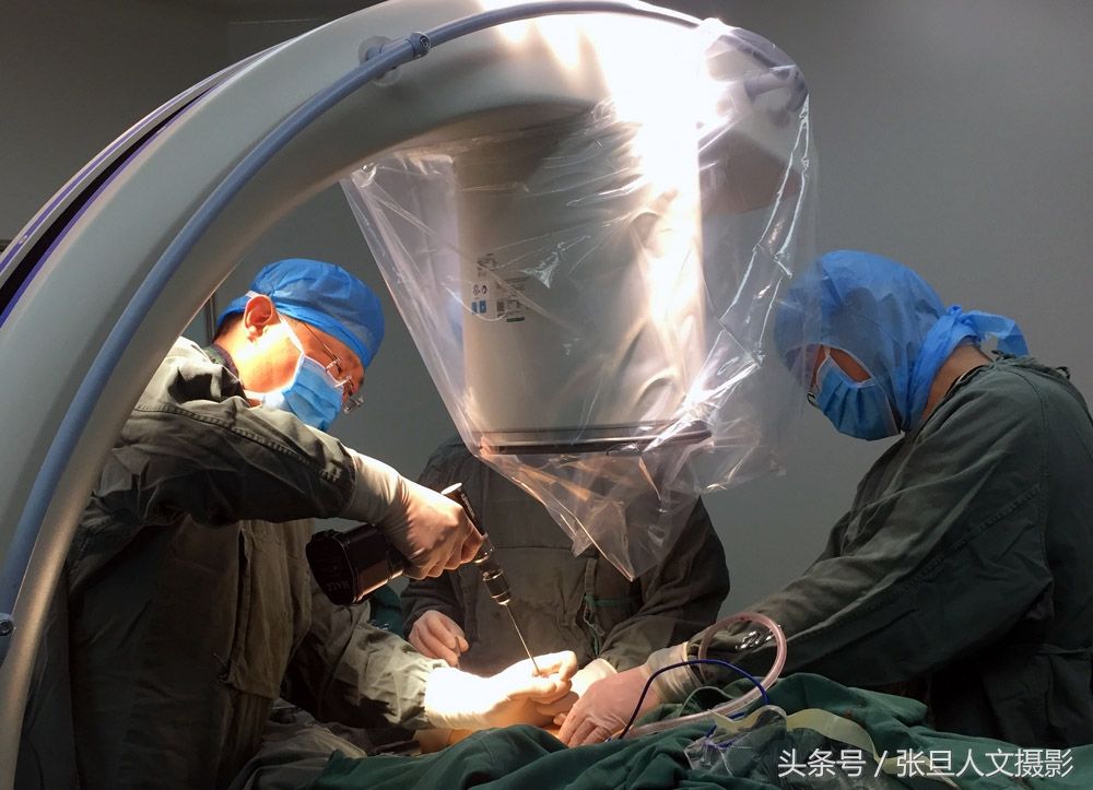 跟骨科主任在手术室给患者做手术 感受到医生