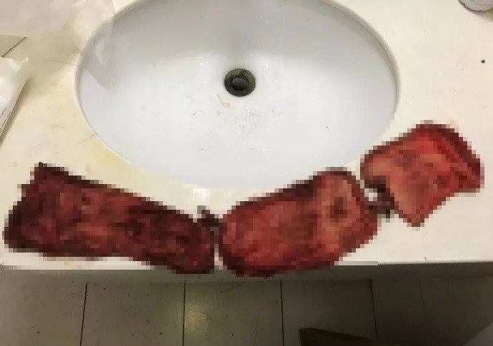 北大人民医院纱布门:道歉能解决的事却闹到满