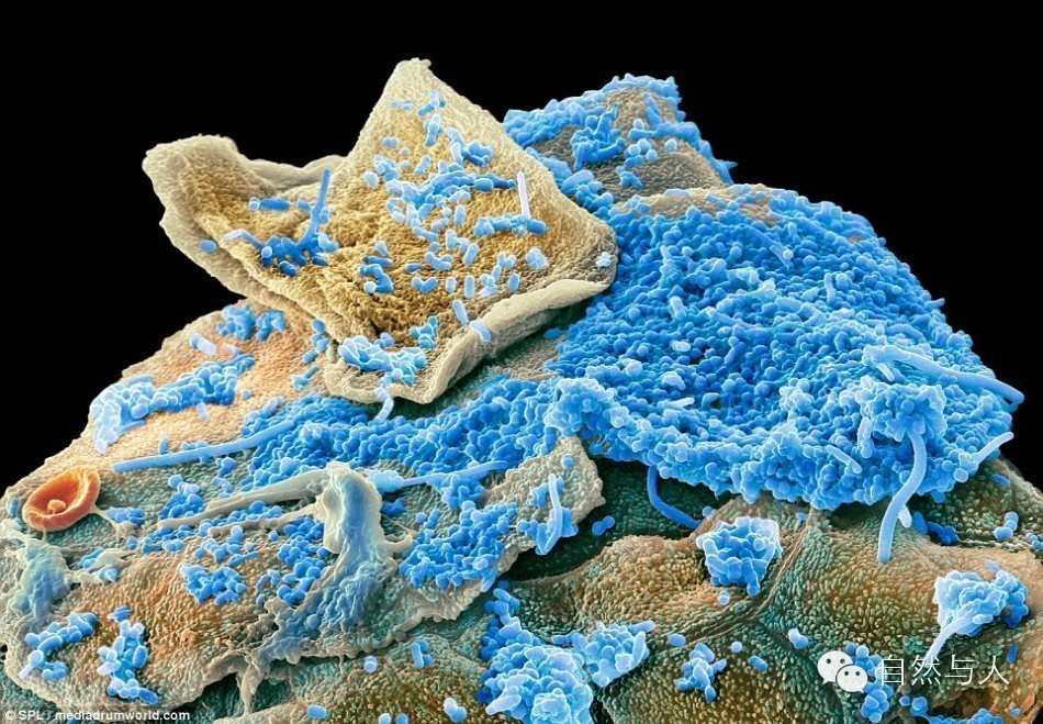 刷牙很重要!看口腔细菌在显微镜下的模样吧