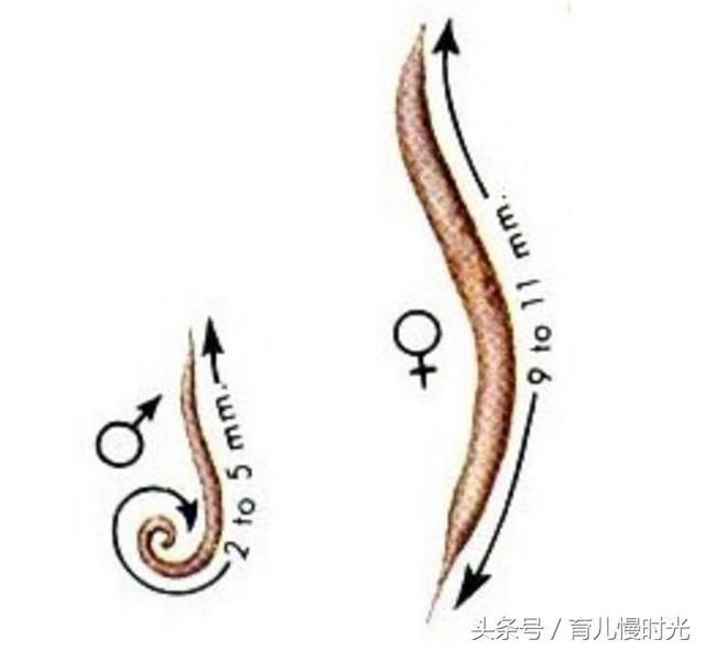 宝宝多大该驱虫?肚里有没有虫子要看这五条,无