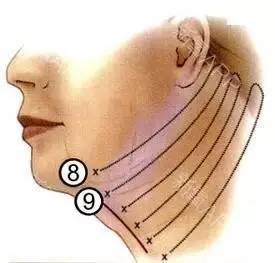 刘亦菲杨幂赵丽颖,究竟什么脸型容易出现双下