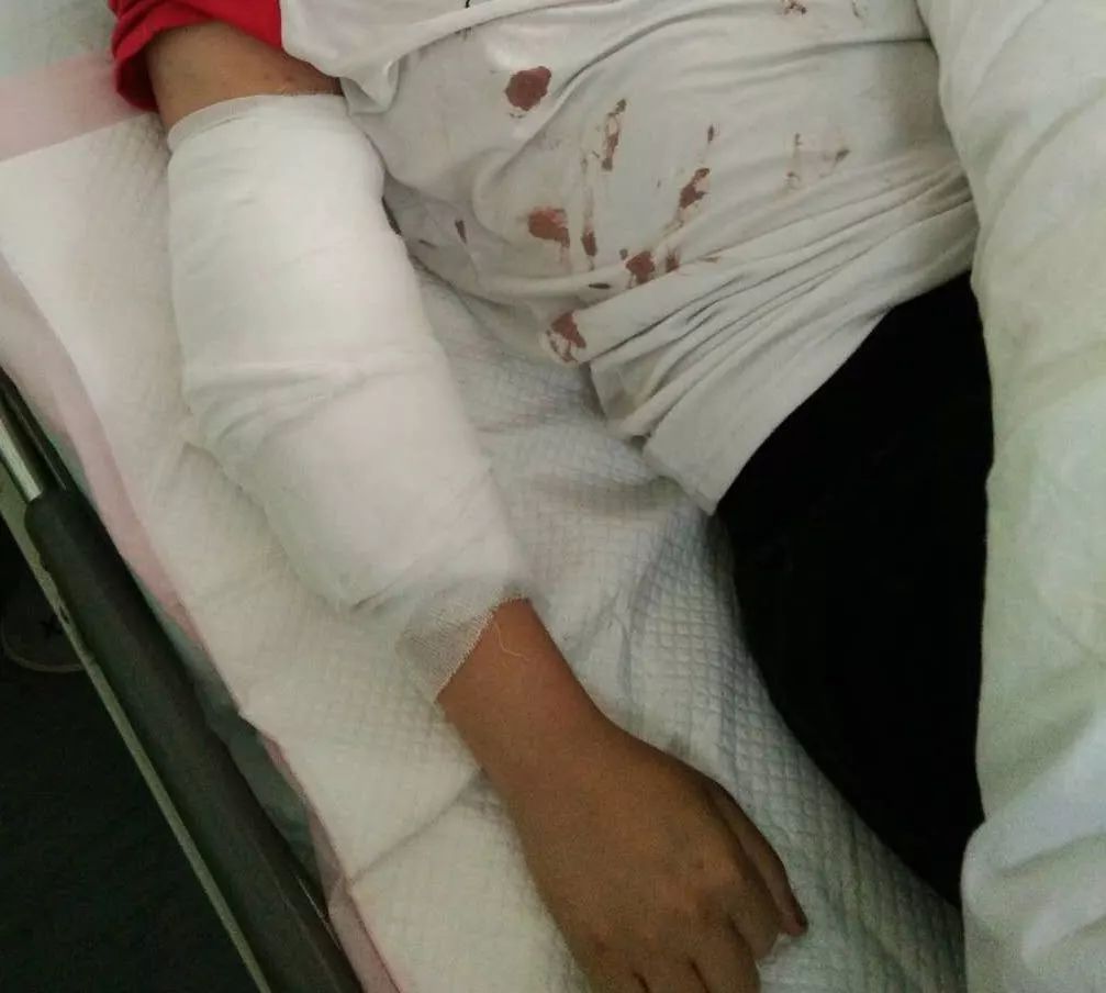 因报案时间距离案发时间较长,对受伤时间确认和伤势程度确认造成