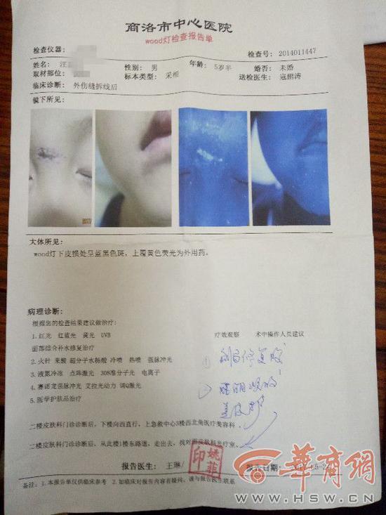 男童幼儿园一月摔两次缝12针 园长:两次皆意外 男童幼儿园一月摔两次缝12针 园长:两次皆意外