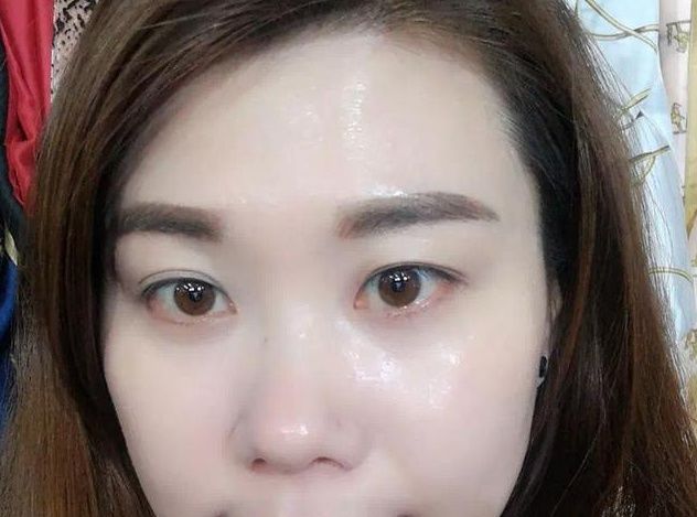 别在每天敷面膜?坚持睡前白醋加一物,一周斑点