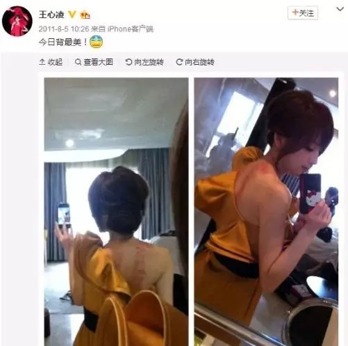 贾乃亮杨幂拔罐,刘涛佟大为刮痧,看大明星们都