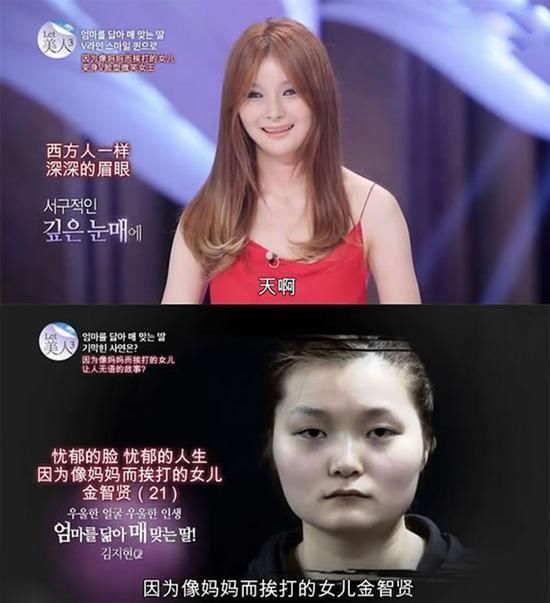 直击:8位韩国丑女整容前后对比照,丑女瞬间变成了大美女