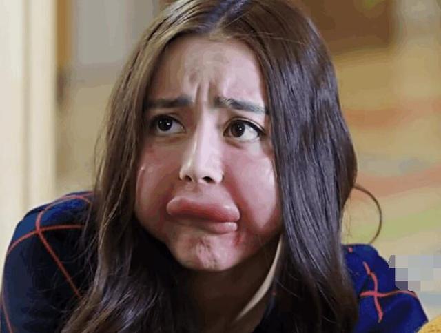 敏感肌或过敏肌?很多人傻傻分不清,这几个鉴别