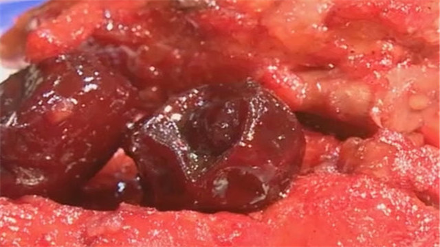 《快乐生活一点通》20180117红火美食 《快乐生活一点通》20180117红火美食