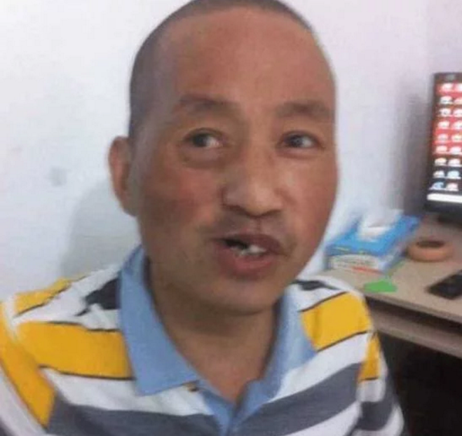 男子癌症自己动手术,不打麻药每天切除一点,原