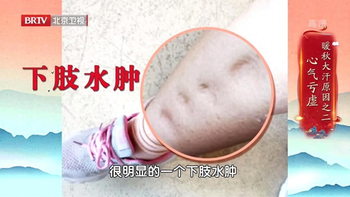 秋季出汗不止，当心身体虚！三个茶饮方，助你敛汗、滋阴又补气！_北京时间