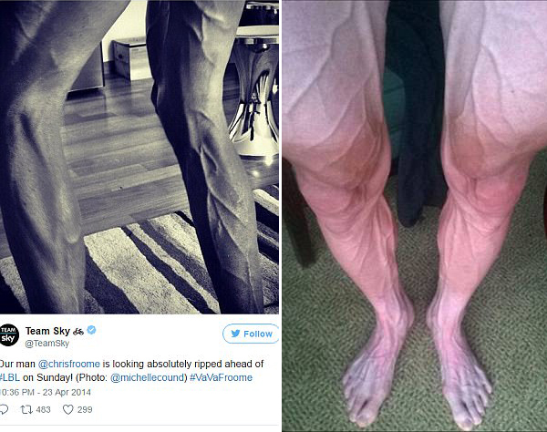 血管爆凸惊悚骇人 自行车运动员比赛后的双腿长这样