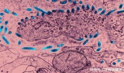 关于幽门螺杆菌,又有了新的发现-北京时间