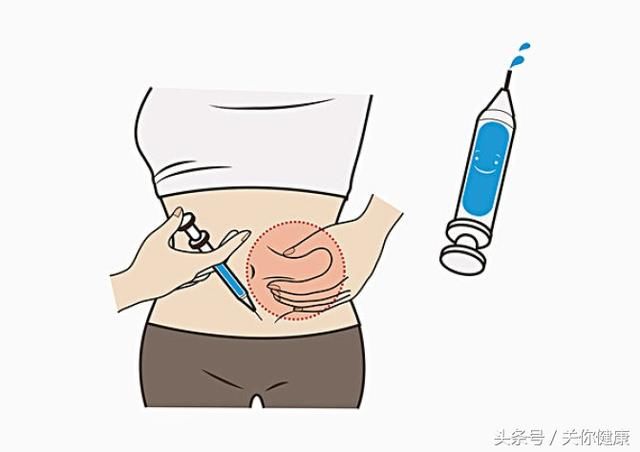 糖尿病分5种,预后各不同,血糖控制目标有了新标准