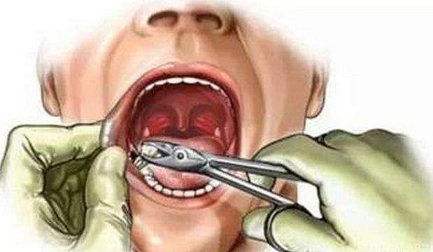 一家小牙科医院做到A股上市这就是文案的魅力