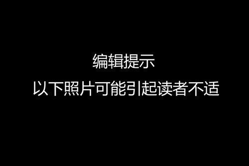 受伤的人不止你一个人 t0128eee6c8705c057a.jpg?size=500x333