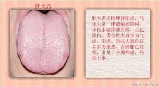 脾虚有哪些最典型的症状?中医辨证施治如何治