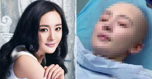 杨幂「光头」新造型曝光网友推爆:光头一样美!