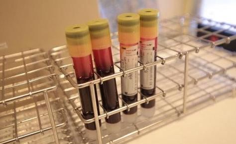 今天讲讲900度近视眼恢复正常的真人案例