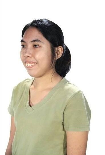 23岁越南女子又黑又丑如同大妈,整容10多次后,被无数男孩子追求