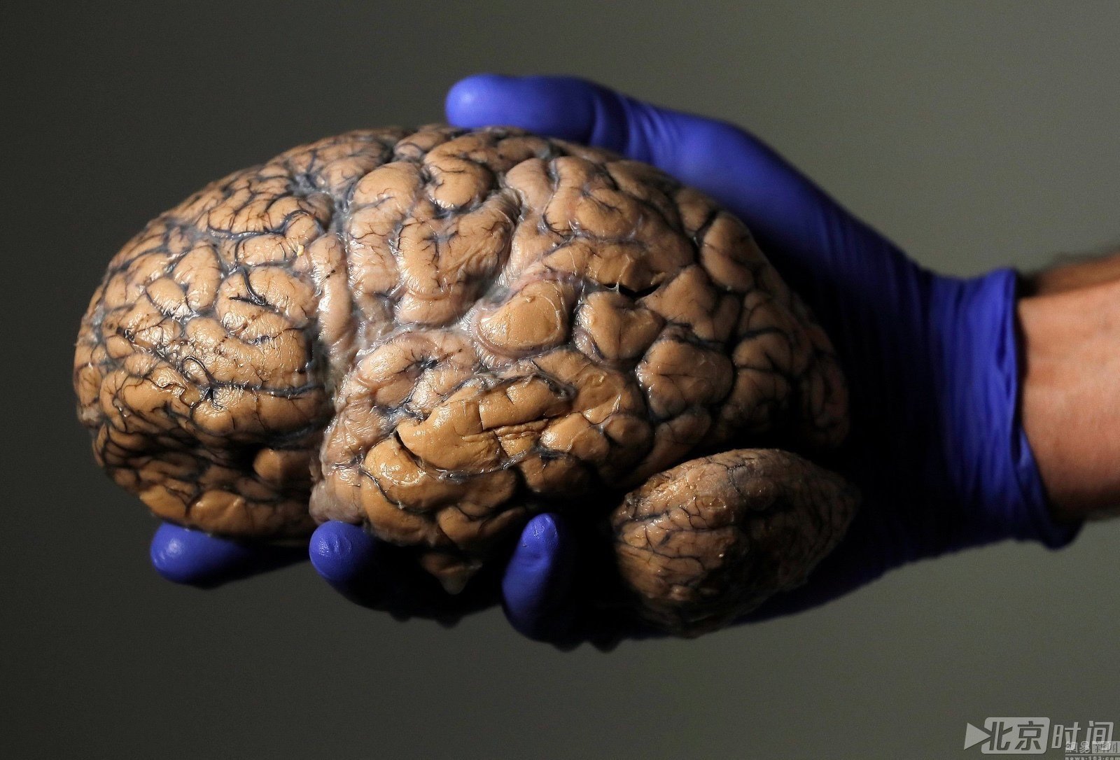 科学怪咖钟爱最强大脑!陈列三千多颗人脑标本