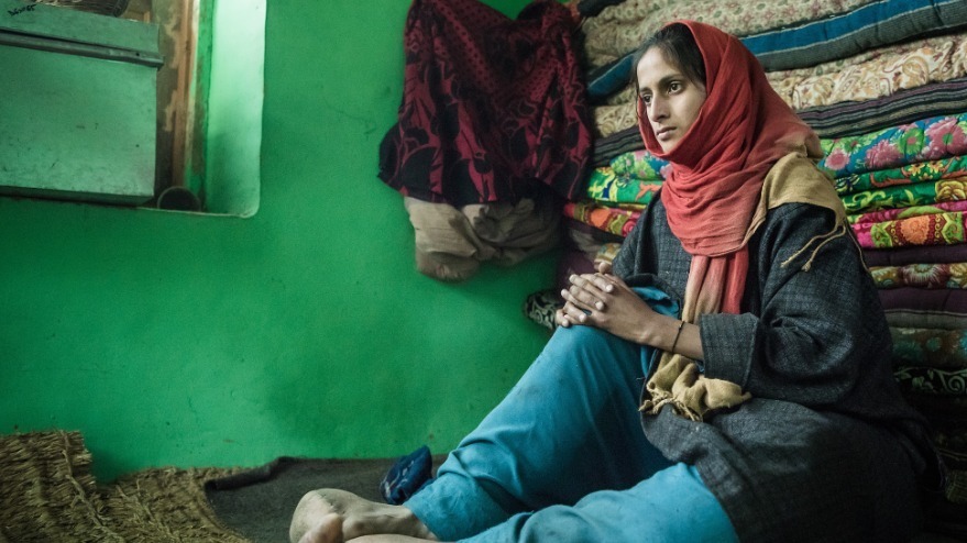 女孩双脚肿如大象腿 唯一梦想是穿上鞋