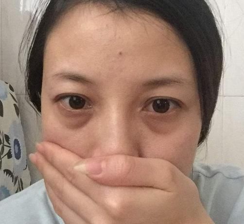 吃完火龙果的皮留着,捣碎加一物睡前抹脸,祛斑