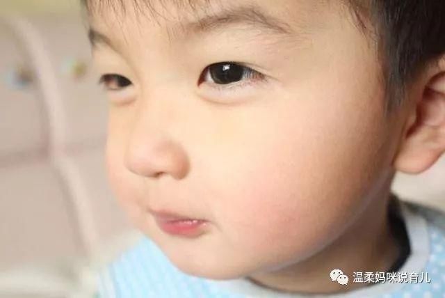 为什么宝宝一生病,单眼皮就会变双眼皮?你家宝